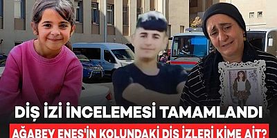 Narin Güran cinayetinde diş izleri ile ilgili çıkan rapor, Narin'i kimin öldürdüğünü aydınlatacak mı?